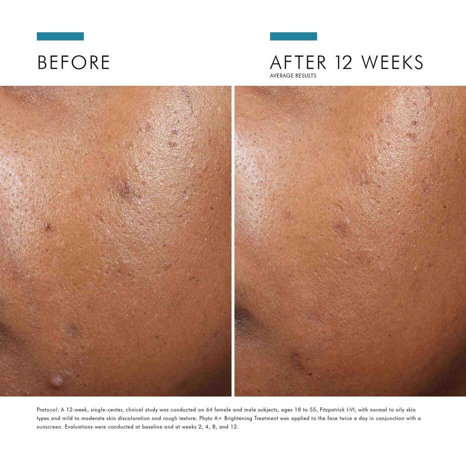 SKINCEUTICALS PHYTO A+ BRIGHTENING TREATMENT