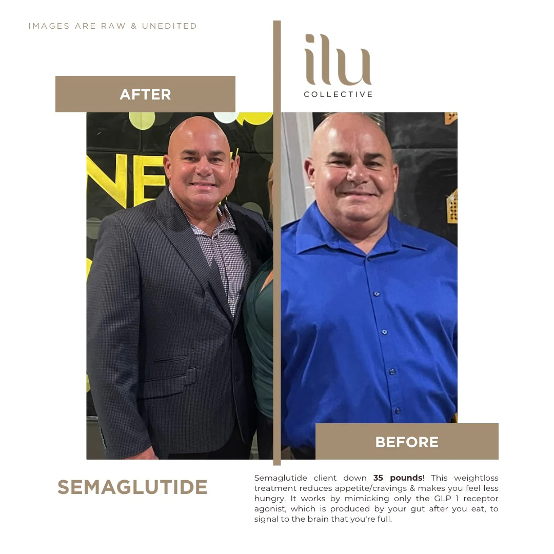 semaglutide coral gables Medical Weight Loss
